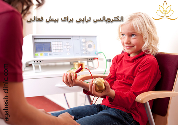 الکتروپالس تراپی برای بیش فعالیagahesh-clinic.com-