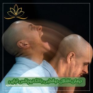 الکتروپالس تراپی برای درمان اختلال دوقطبی - کلینیک آگاهش